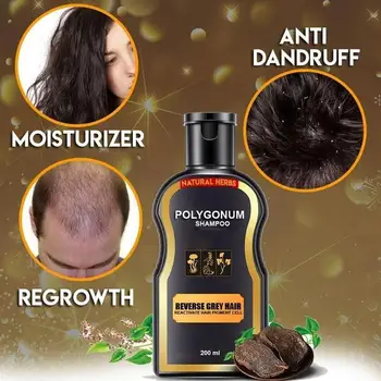 200 ml ošetrenie vlasov šampón starostlivosť o vlasy rast vlasov vlasy anti A3U3