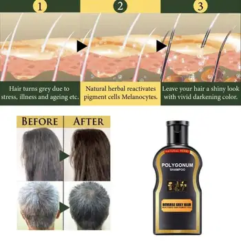 Vlasy Šampón, Čierna Farba, Anti Šedivé Vlasy Liečba Biela Odstránenie Natural Herbal Hair Shampoo Polygonum Multiflorum Zázvor 30ml