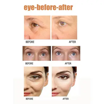 1Pcs Rýchle Okamžite Očný Krém na Odstránenie Tmavých Kruhov Jemné Linky Očí Bag Anti-Aging Anti-Wrinkle Hlboko Hydratačný Očný Krém TSLM1