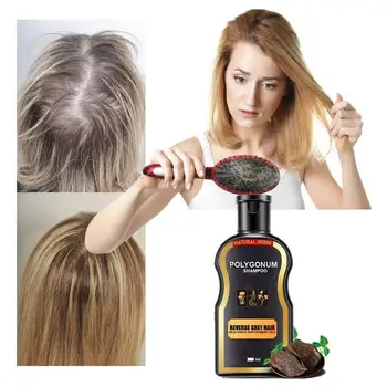 200 ml ošetrenie vlasov šampón starostlivosť o vlasy rast vlasov vlasy anti A3U3